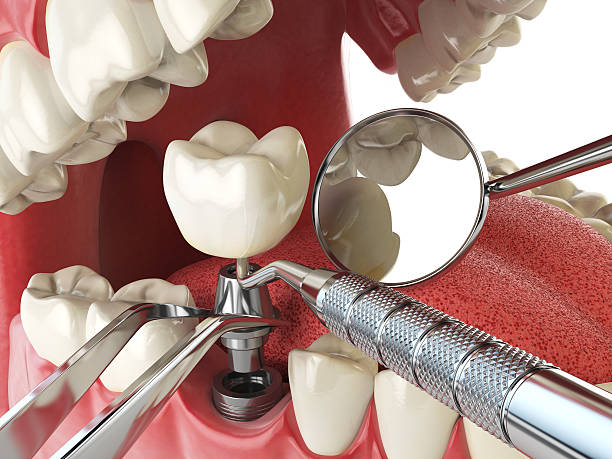 Best Emergency Orthodontic Repairs in Gordonsville, VA